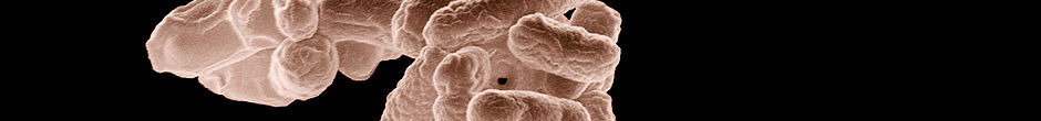 http://reviewed-production.s3.amazonaws.com/attachment/7e742b96a0e4a392616a364ce92c82c9b522e249/s940x110_bacteria_hero.jpg